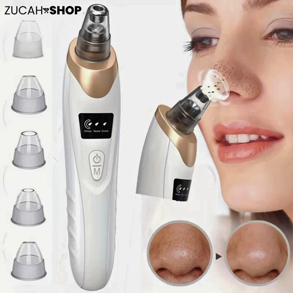 Removedor de Puntos Negros con Succión – Limpieza Facial Profunda y Microdermoabrasión Portátil
