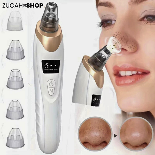 Removedor de Puntos Negros con Succión – Limpieza Facial Profunda y Microdermoabrasión Portátil